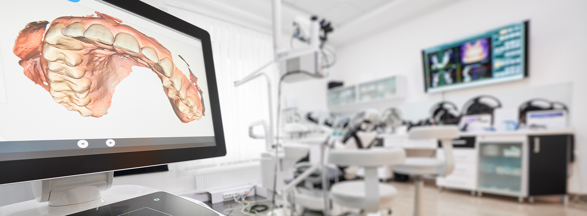 Anatomical model displayed on a computer screen in a dental office setting, with a monitor and various medical equipment visible in the background.