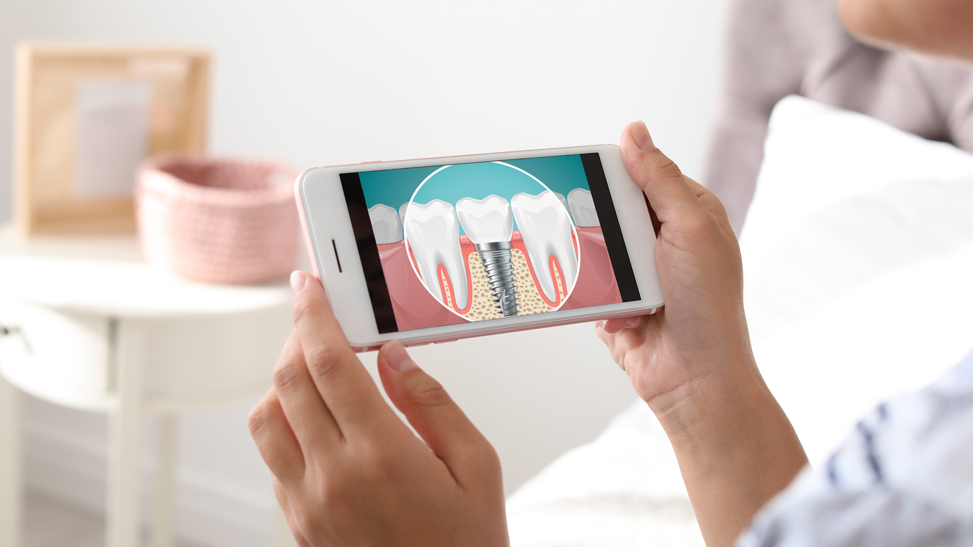 A person holding a smartphone displaying an image of teeth with highlighted dental implants.