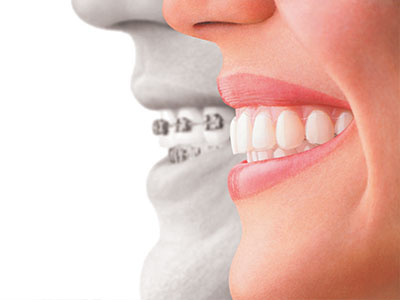 The image features a split-screen comparison of a person s natural smile and their smile after dental treatment, with the focus on oral hygiene and cosmetic dentistry.