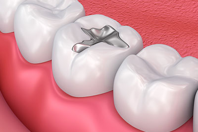The image displays a close-up view of a human tooth with an implant, set against a pink background that resembles gum tissue.