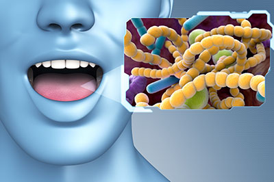 The image features a 3D rendering of a human head with an open mouth, superimposed on a background graphic displaying a microscopic view of bacteria or viruses.