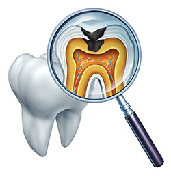 The image shows a magnified view of a tooth with a cross-section illustrating its internal structure, including the pulp chamber, nerve, and blood vessels, with a dental probe pointing towards these features for examination purposes.