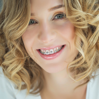A smiling woman with straight teeth and braces, wearing a white top and curly blonde hair, posing for a portrait.