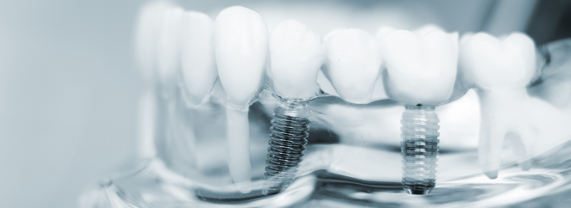 The image shows a close-up view of multiple teeth with visible enamel surfaces, placed on a transparent surface which appears to be a dental cast or model, with a focus on the tooth enamel texture and a watermark that reads  studio 32.