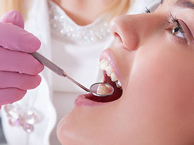 A dental professional using a drill on a patient s teeth during a dental procedure.