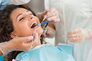 dental_extractions_kendall_county